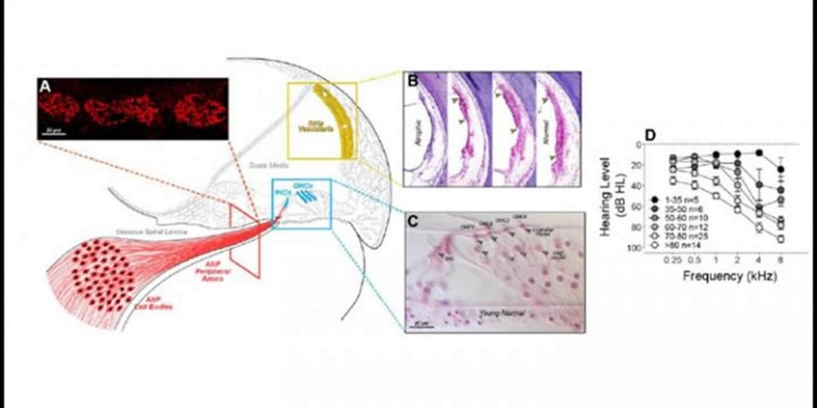 This is a diagram from the study