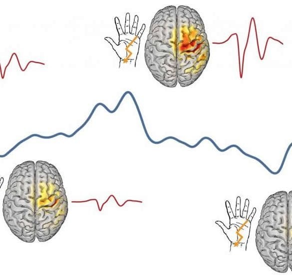 This shows brains