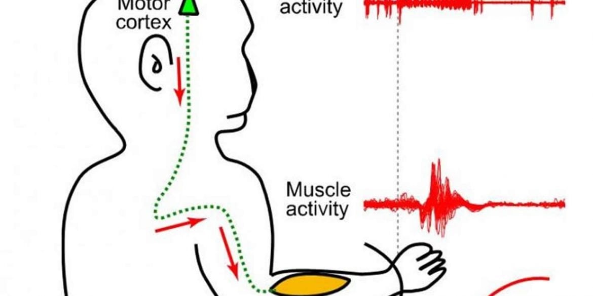 This is a diagram from the study