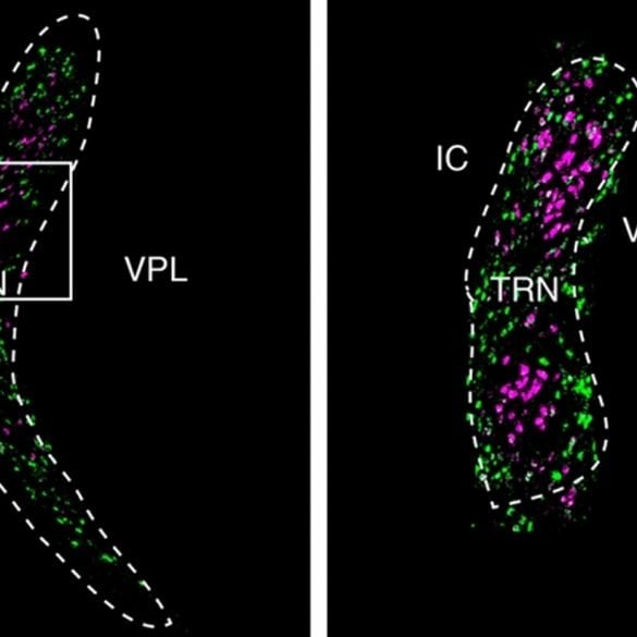 This shows the neurons mapped in the TRN
