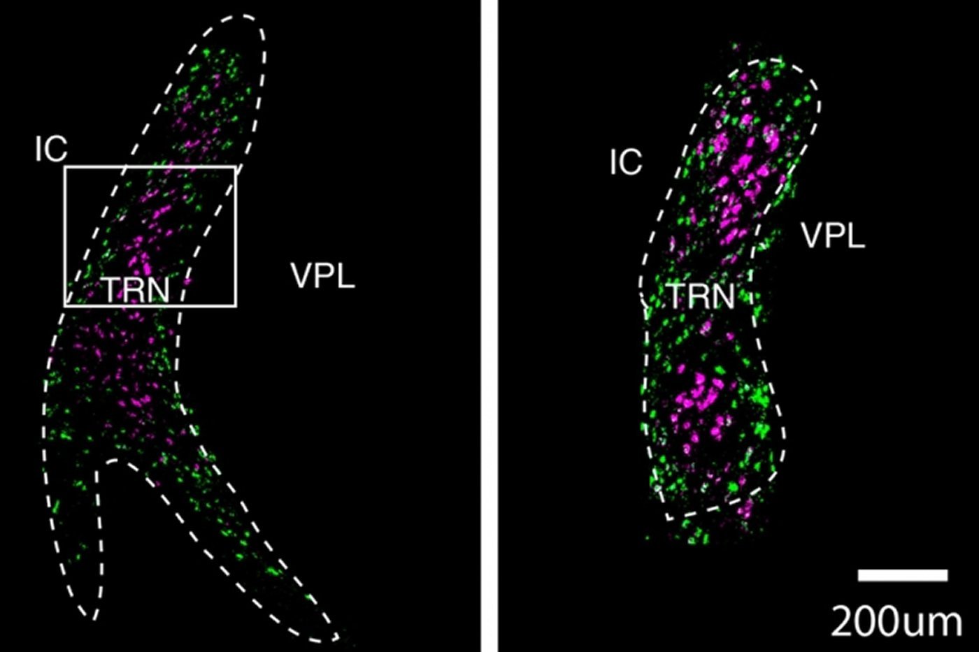 This shows the neurons mapped in the TRN