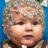 This shows a baby in an EEG helm