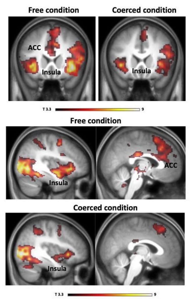 This shows brain scans from the study