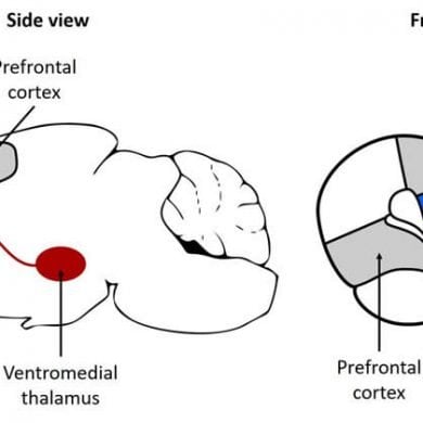 This shows the location of the ventromedia thalamus in a mouse brain