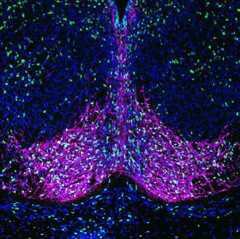 This shows dopamine neurons