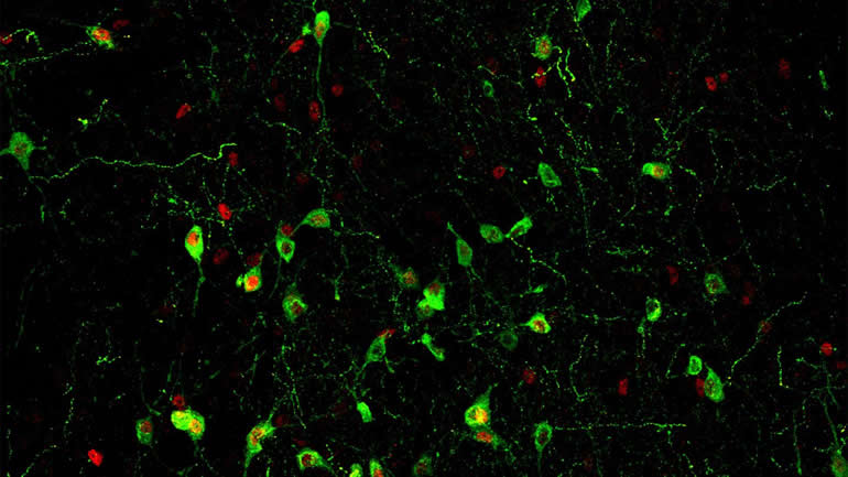 This shows hypothalamic neurons