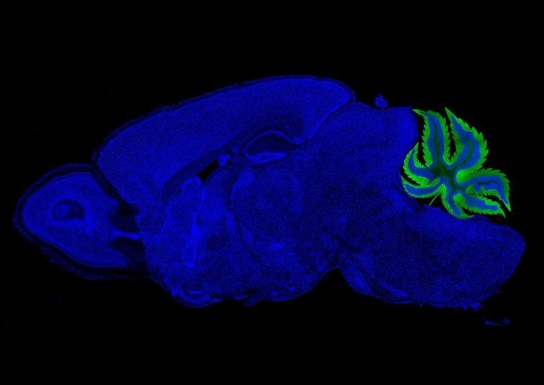 The cerrebellum in this brain image is replaces with a cannabis leaf