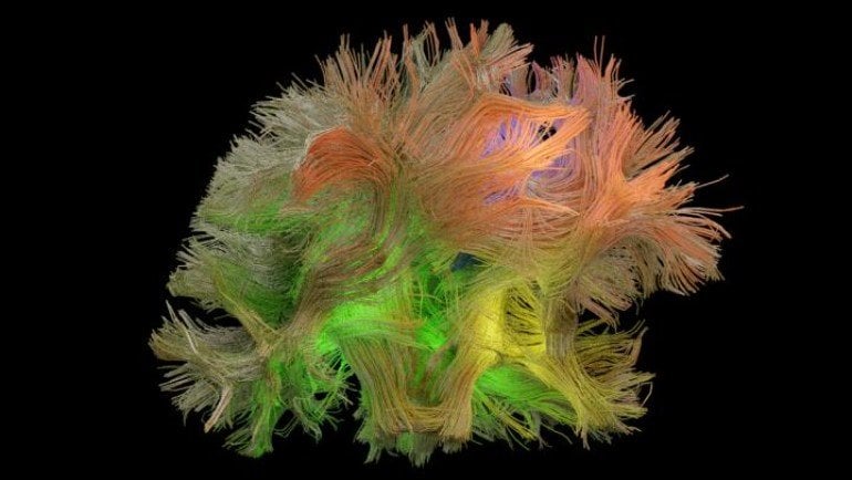 This shows a brain