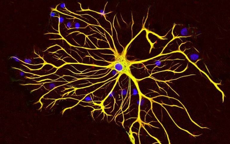 This shows astrocytes