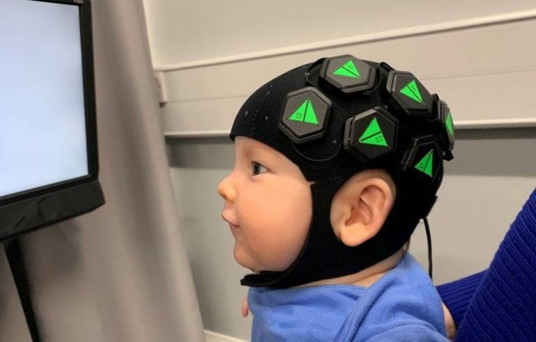 Wearable Imaging Cap Provides a Window Into Babies' Brains