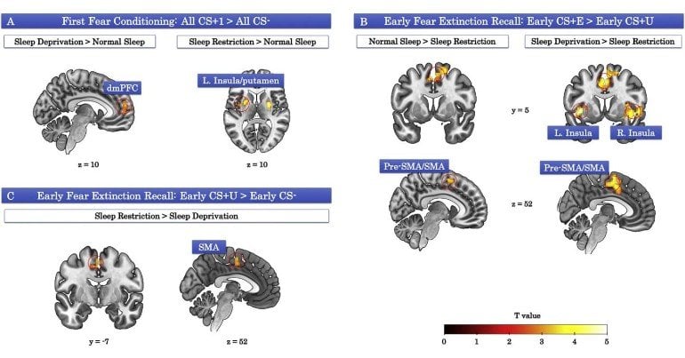 This shows brain scans from the study