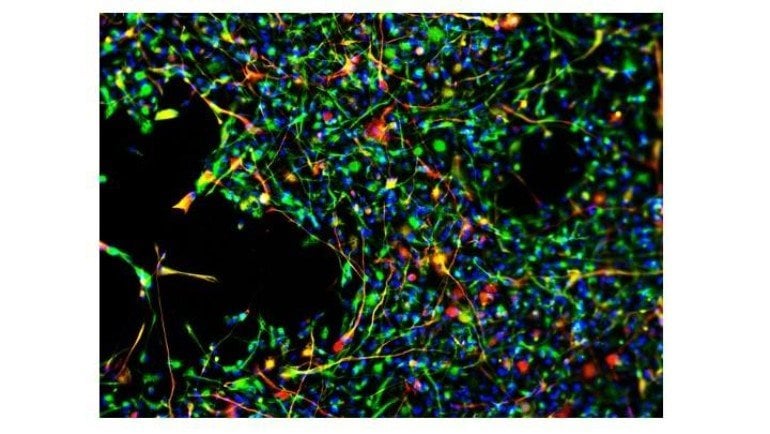 This shows stem cells turning into astrocytes