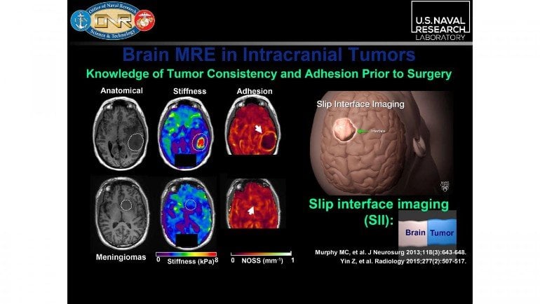 This shows brain scans from the study