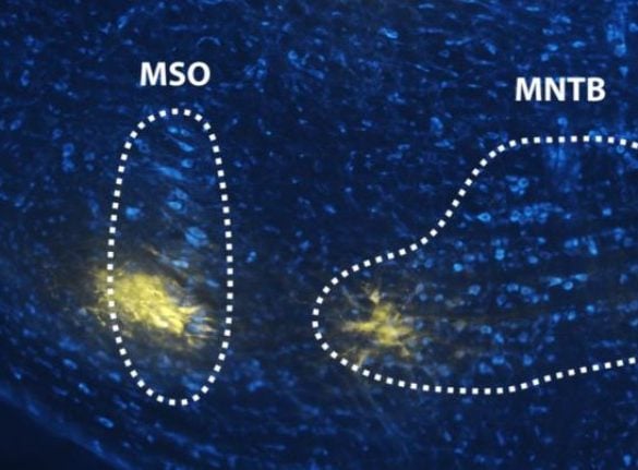 This shows the MSO and MNTB