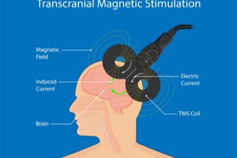 This is a diagram from the study