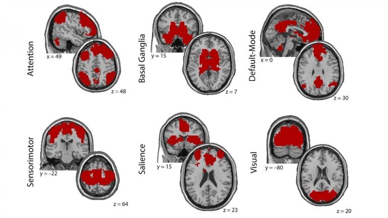 This shows brain scans from the study