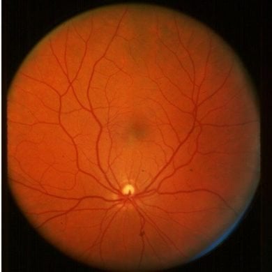 This shows a retinal scan
