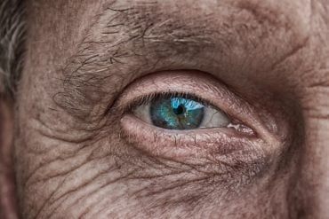 This shows a blue-green eye of an older man