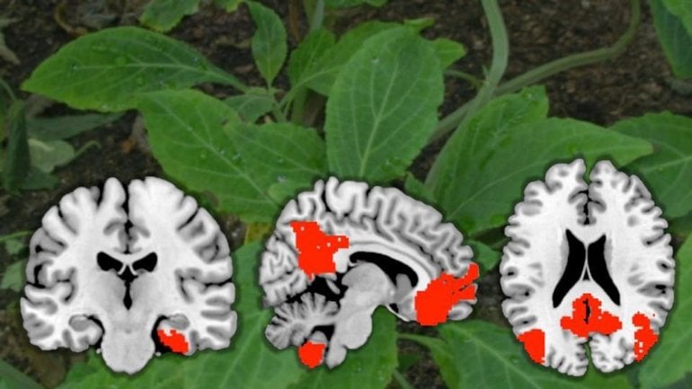 This shows plant leaves and brain scans from the study