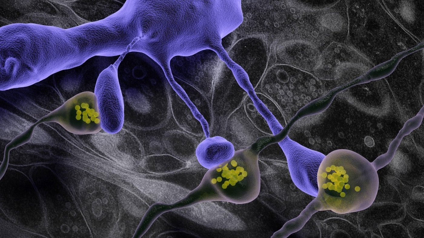 This image shows dendritic spines making synapses with axons