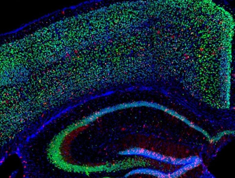 This shows a brain slice of the hippocampus