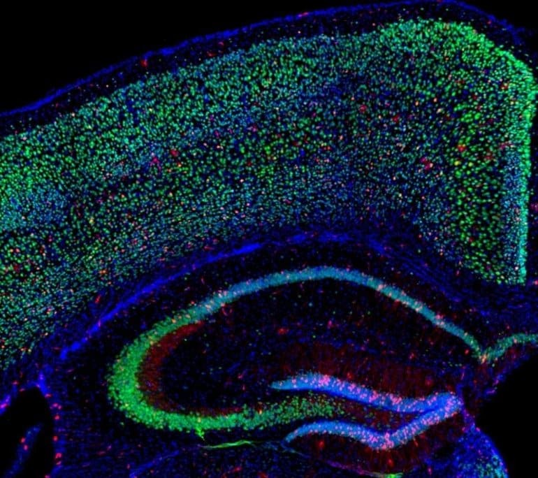 This shows a brain slice of the hippocampus