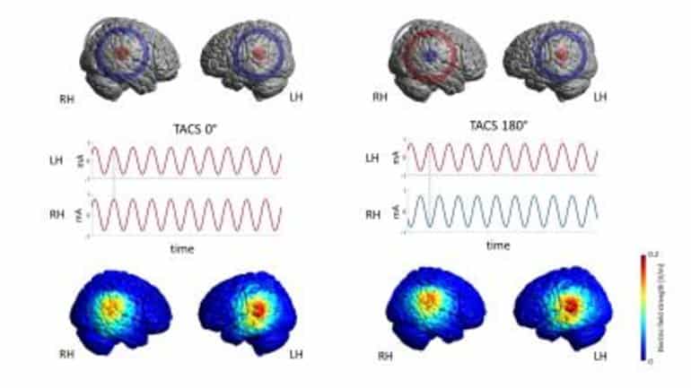 This image shows brain scans from the study