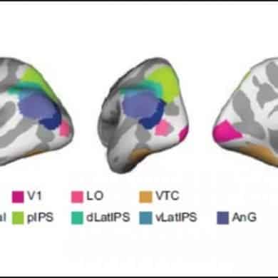 This shows brain scans