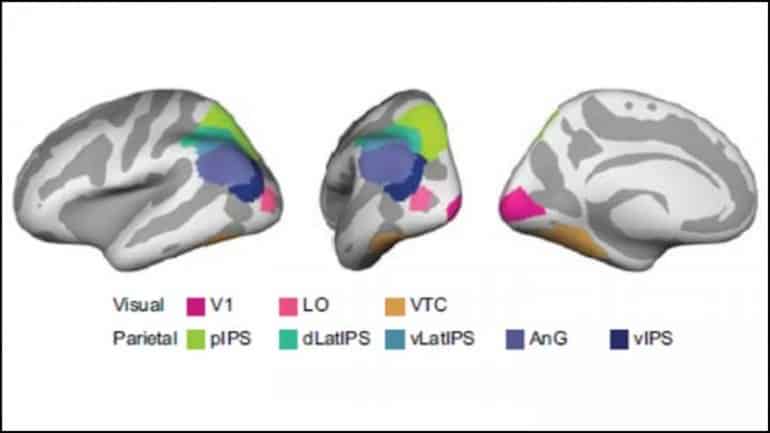 This shows brain scans