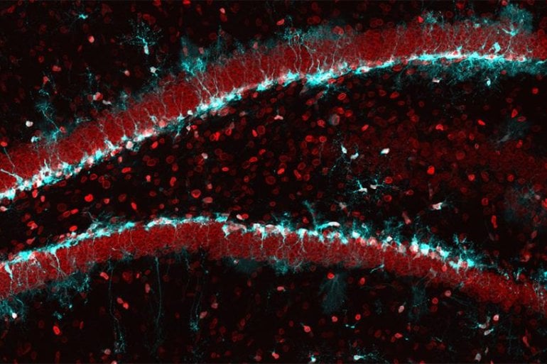 This shows neural stem cells in the hippocampus