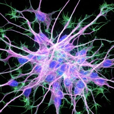 This shows a neuron