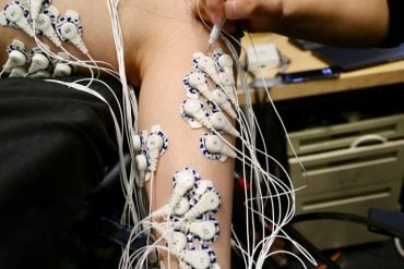 This shows electrodes attached to an arm