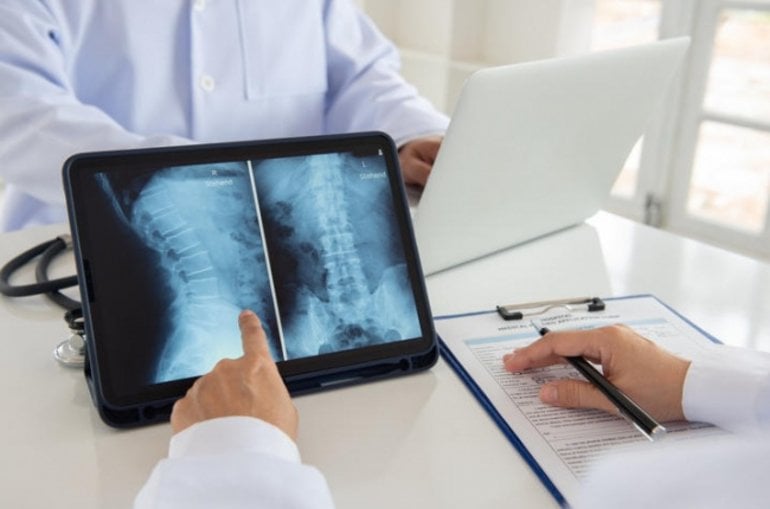This shows a doctor looking at a spinal cord x ray