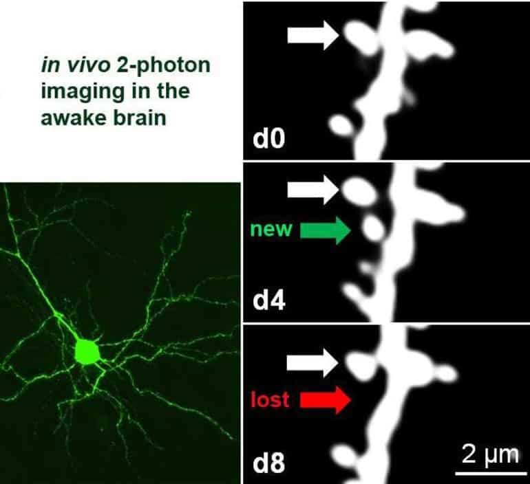 This shows neurons and dendrites