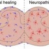 This is an illustration of the spinal cord with the cells