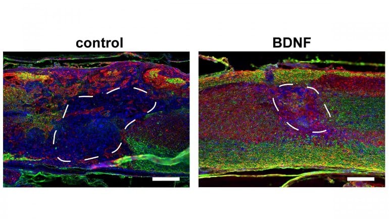 This shows mylinated axons