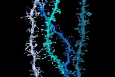 This is a 3D reconstruction of dendrites