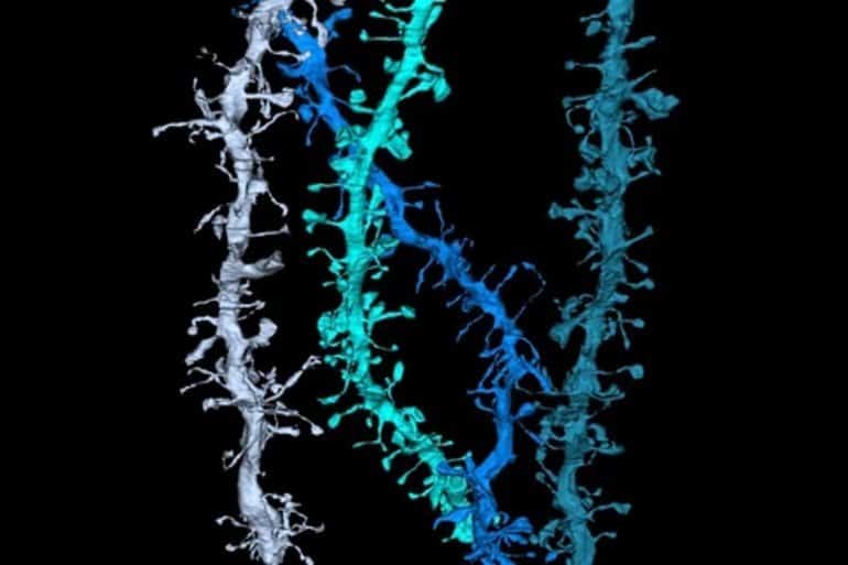 Questa è una ricostruzione 3D dei dendriti