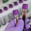 This shows a hand holding up blood in test tubes