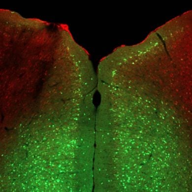 This shows a brain slice from a mouse
