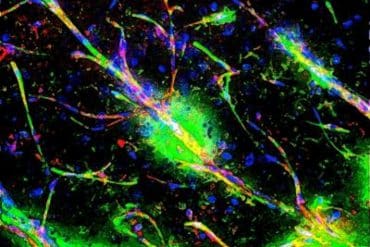 The Immune Link Between a Leaky Blood-Brain Barrier and Schizophrenia ...