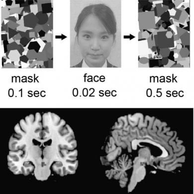 This shows a woman's face and brain scans from the study