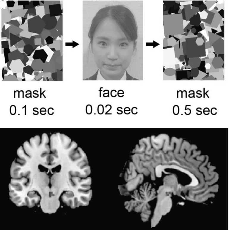 This shows a woman's face and brain scans from the study