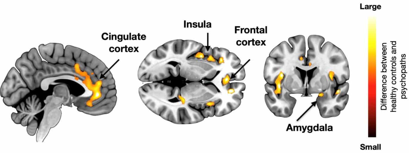 This shows brain scans from the study