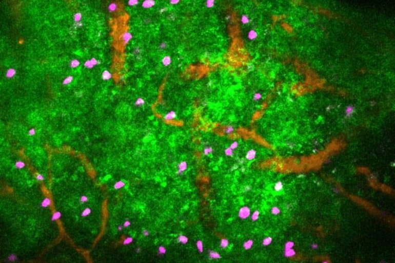 This shows lymphocytes