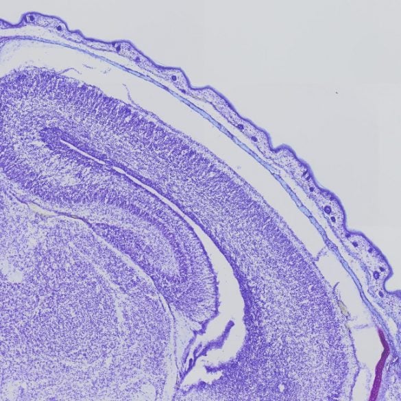 This shows a brain slice