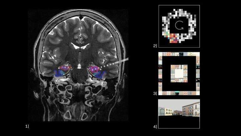 This shows a brain scan and pictures of buildings
