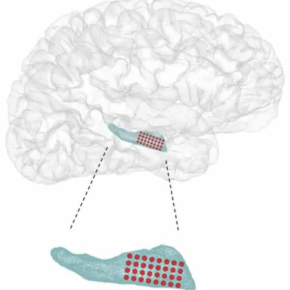 This shows the location of the hippocampus in the brain