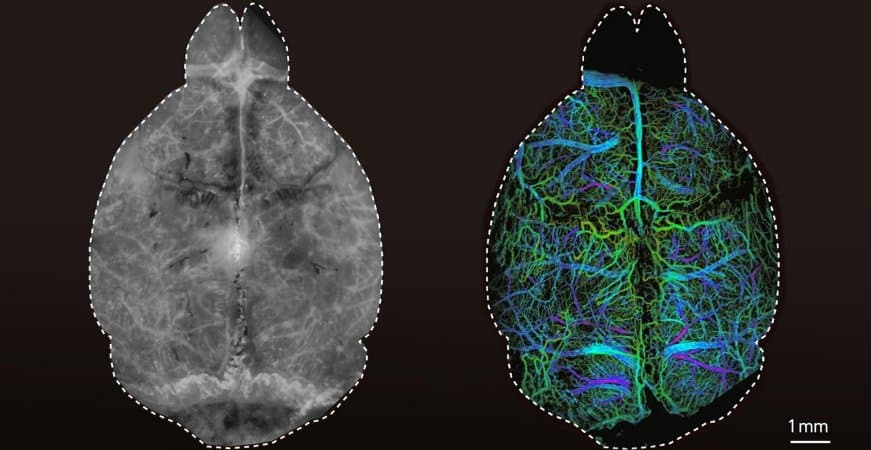 This shows two different images of a mouse brain. One is colored by the DOLI method