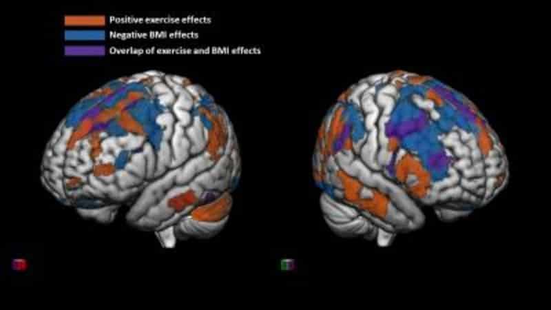 This shows brain scans from the study